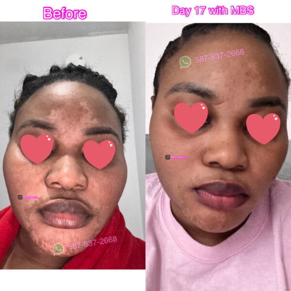 Repair Face Kit - Image 12