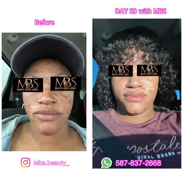 Repair Face Kit - Image 11