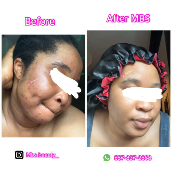 Repair Face Kit - Image 10